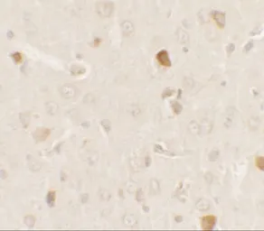 Anti-PRAS40 antibody used in IHC (Paraffin sections) (IHC-P). GTX31882