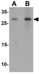 Anti-PRAS40 antibody used in Western Blot (WB). GTX31882