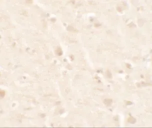 Anti-beta 2 Microglobulin antibody used in IHC (Paraffin sections) (IHC-P). GTX31884