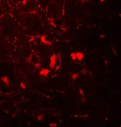 Anti-beta 2 Microglobulin antibody used in IHC (Paraffin sections) (IHC-P). GTX31884