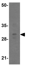 Anti-TFPI antibody used in Western Blot (WB). GTX31885