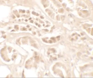 Anti-Kallikrein 4 antibody used in IHC (Paraffin sections) (IHC-P). GTX31887