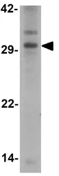 Anti-Kallikrein 4 antibody used in Western Blot (WB). GTX31887
