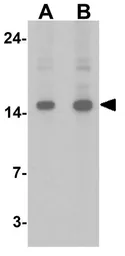Anti-FHIT antibody used in Western Blot (WB). GTX31890