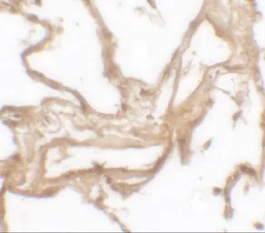 Anti-MMP9 antibody used in IHC (Paraffin sections) (IHC-P). GTX31891