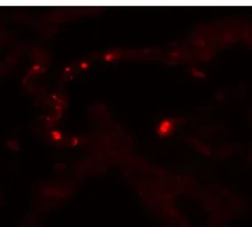 Anti-MMP9 antibody used in IHC (Paraffin sections) (IHC-P). GTX31891