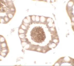 Anti-CD272 antibody used in IHC (Paraffin sections) (IHC-P). GTX31892