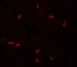 Anti-CD272 antibody used in IHC (Paraffin sections) (IHC-P). GTX31892