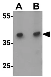 Anti-CD272 antibody used in Western Blot (WB). GTX31892