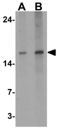 Anti-IL28B antibody used in Western Blot (WB). GTX31893