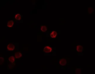 Anti-IL28B antibody used in Immunocytochemistry/ Immunofluorescence (ICC/IF). GTX31893