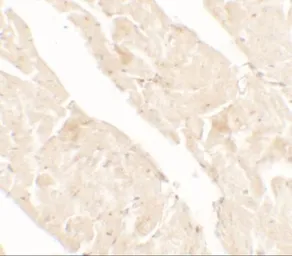 Anti-AIMP2 antibody used in IHC (Paraffin sections) (IHC-P). GTX31896