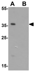 Anti-AIMP2 antibody used in Western Blot (WB). GTX31896