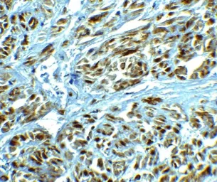 Anti-LRRC26 antibody used in IHC (Paraffin sections) (IHC-P). GTX31897