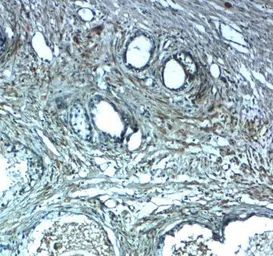 Anti-LRRC26 antibody used in IHC (Paraffin sections) (IHC-P). GTX31897