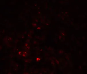 Anti-LRRC26 antibody used in IHC (Paraffin sections) (IHC-P). GTX31897