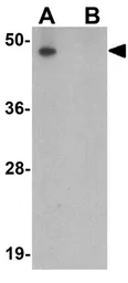 Anti-LRRC26 antibody used in Western Blot (WB). GTX31897