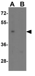 Anti-LRRC26 antibody used in Western Blot (WB). GTX31897