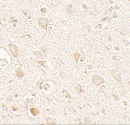 Anti-LC3A antibody used in IHC (Paraffin sections) (IHC-P). GTX31898