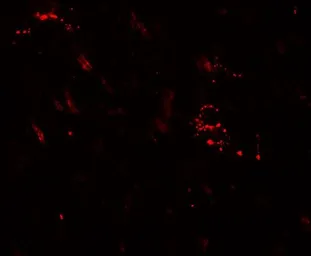 Anti-LC3A antibody used in IHC (Paraffin sections) (IHC-P). GTX31898
