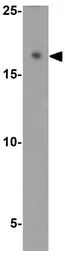 Anti-LC3A antibody used in Western Blot (WB). GTX31898
