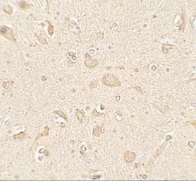 Anti-LC3B antibody used in IHC (Paraffin sections) (IHC-P). GTX31899
