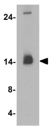 Anti-LC3B antibody used in Western Blot (WB). GTX31899