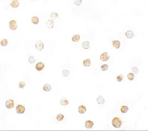 Anti-DRP1 antibody used in Immunocytochemistry/ Immunofluorescence (ICC/IF). GTX31901
