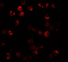 Anti-DRP1 antibody used in Immunocytochemistry/ Immunofluorescence (ICC/IF). GTX31901