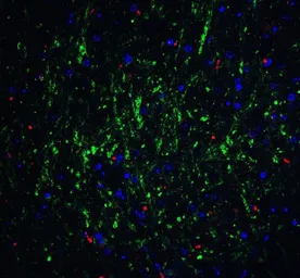 Anti-RPSA antibody used in IHC (Paraffin sections) (IHC-P). GTX31902