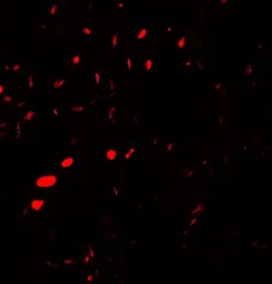 Anti-Aquaporin 2 antibody used in IHC (Paraffin sections) (IHC-P). GTX31904