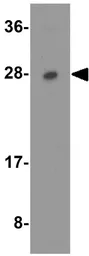Anti-Aquaporin 2 antibody used in Western Blot (WB). GTX31904