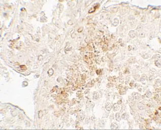 Anti-GLIPR1L1 antibody used in IHC (Paraffin sections) (IHC-P). GTX31905