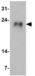 Anti-GLIPR1L1 antibody used in Western Blot (WB). GTX31905