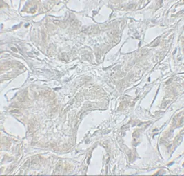 Anti-ARF6 antibody used in IHC (Paraffin sections) (IHC-P). GTX31908
