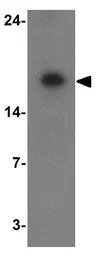 Anti-ARF6 antibody used in Western Blot (WB). GTX31908
