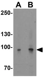 Anti-PGC1 alpha antibody used in Western Blot (WB). GTX31910