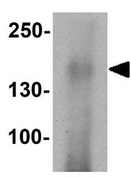 Anti-CFTR antibody used in Western Blot (WB). GTX31913