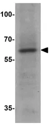 Anti-ME1 antibody used in Western Blot (WB). GTX31914