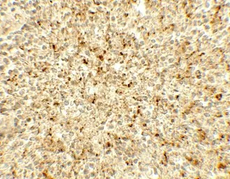 Anti-ME2 antibody used in IHC (Paraffin sections) (IHC-P). GTX31915