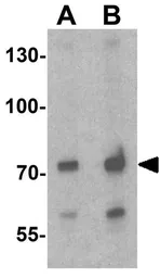 Anti-ATMIN antibody used in Western Blot (WB). GTX31920