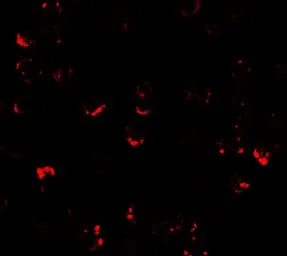 Anti-ATMIN antibody used in Immunocytochemistry/ Immunofluorescence (ICC/IF). GTX31920