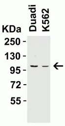 Anti-PGC1 alpha antibody used in Western Blot (WB). GTX31921