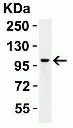 Anti-PGC1 alpha antibody used in Western Blot (WB). GTX31921