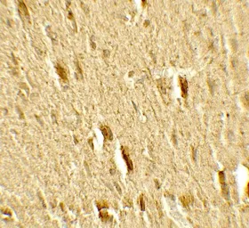 Anti-MFN2 antibody used in IHC (Paraffin sections) (IHC-P). GTX31923