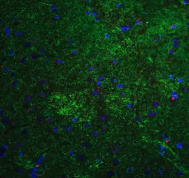 Anti-MFN2 antibody used in IHC (Paraffin sections) (IHC-P). GTX31923