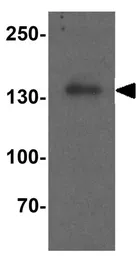 Anti-HDAC6 antibody used in Western Blot (WB). GTX31926