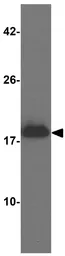 Anti-alpha Synuclein antibody used in Western Blot (WB). GTX31928