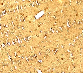 Anti-LC3A antibody used in IHC (Paraffin sections) (IHC-P). GTX31934