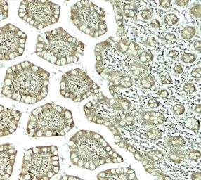 Anti-CTHRC1 antibody used in IHC (Paraffin sections) (IHC-P). GTX31944